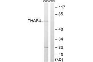 Western blot analysis of extracts from COS7 cells, using THAP4 Antibody. (THAP4 antibody  (AA 341-390))