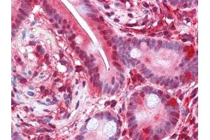 Immunohistochemical analysis of paraffin-embedded human Small Intestine tissues using PAR4 antibody (F2RL3 antibody  (AA 1-330))