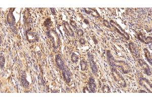 Immunohistochemistry (IHC) image for anti-Transglutaminase 2 (C Polypeptide, Protein-Glutamine-gamma-Glutamyltransferase) (TGM2) (AA 1-687) antibody (ABIN7434158)