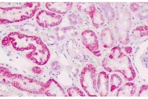 Human Kidney, Tubules: Formalin-Fixed, Paraffin-Embedded (FFPE) (CTNNA1 antibody  (AA 30-59))