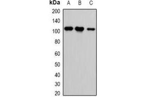Western blot analysis of CASK expression in HEK293T (A), H460 (B), A549 (C) whole cell lysates. (CASK antibody)