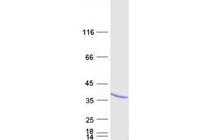 Western Blotting (WB) image for ARD1 Homolog, N-Acetyltransferase (ARD1A) protein (Myc-DYKDDDDK Tag) (ABIN2726749)