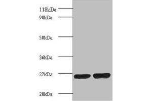 Western blot All lanes: Proteasome subunit beta 1 antibody at 2 μg/mL Lane 1: EC109 whole cell lysate Lane 2: 293T whole cell lysate Secondary Goat polyclonal to rabbit IgG at 1/15000 dilution Predicted band size: 27 kDa Observed band size: 27 kDa (PSMB1 antibody  (AA 29-241))