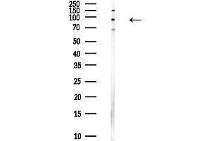 anti-Zinc Finger Protein 341 (ZNF341) antibody