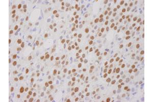 Immunohistochemistry (IHC) image for anti-REST Corepressor 1 (RCOR1) (C-Term) antibody (ABIN7448481) (CoREST antibody  (C-Term))