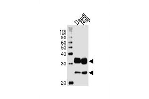 Lane 1: Daudi, Lane 2: Raji cell lysate at 20 µg per lane, probed with bsm-51440M CD74 (1267CT820. (CD74 antibody)