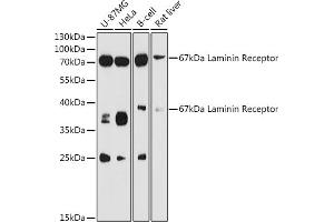 Western blot analysis of extracts of various cell lines, using 67 kDa Laminin Receptor antibody (ABIN6128199, ABIN6147247, ABIN6147248 and ABIN6224857) at 1:3000 dilution. (RPSA/Laminin Receptor antibody  (AA 1-295))