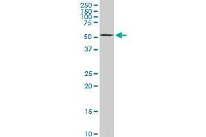 AKT2 monoclonal antibody (M04A), clone 1F8. (AKT2 antibody  (AA 100-189))