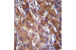 Immunohistochemistry analysis in formalin fixed and paraffin embedded human liver tissue reacted with GNE / GLCNE Antibody (N-term) followed by peroxidase conjugation of the secondary antibody and DAB staining. (GNE antibody  (N-Term))