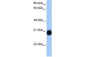 IGFBP7 antibody used at 1 ug/ml to detect target protein. (IGFBP7 antibody  (C-Term))