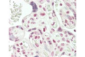 Formalin-fixed and paraffin-embedded H. (ARHGAP17 antibody  (N-Term))