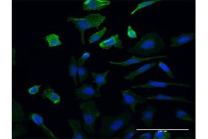 Immunofluorescence of monoclonal antibody to UMPS on HeLa cell. (UMPS antibody  (AA 381-479))
