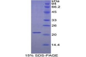 SDS-PAGE (SDS) image for Inter alpha Globulin Inhibitor H5 (ITIH5) (AA 569-737) protein (His tag) (ABIN2121323)