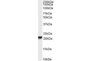 Image no. 1 for anti-Retinol Binding Protein 4, Plasma (RBP4) (Internal Region) antibody (ABIN375237)
