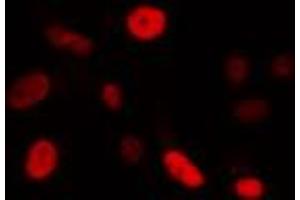 ABIN6274340 staining Hela cells by IF/ICC. (FOXE3 antibody  (Internal Region))