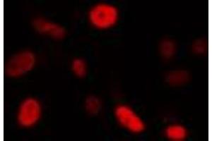 ABIN6274340 staining Hela cells by IF/ICC. (FOXE3 antibody  (Internal Region))