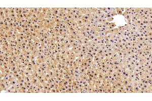 Detection of FABP1 in Rat Liver Tissue using Polyclonal Antibody to Fatty Acid Binding Protein 1 (FABP1) (FABP1 antibody  (AA 2-127))
