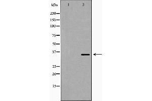 Western blot analysis of extracts of Jurkat , using PPP2CB antibody. (PPP2CB antibody  (C-Term))