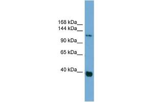 WB Suggested Anti-CTNND1 Antibody Titration: 0. (CTNND1 antibody  (Middle Region))