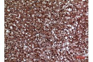 Immunohistochemistry (IHC) analysis of paraffin-embedded Human Liver, antibody was diluted at 1:100. (F11R antibody  (Internal Region))