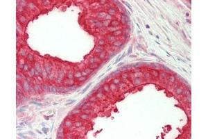 Human Prostate: Formalin-Fixed, Paraffin-Embedded (FFPE) (NEDD4-2 antibody  (AA 225-275))