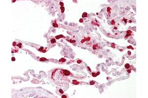 Anti-GSTT1 antibody IHC of human lung. (GSTT1 antibody  (C-Term))