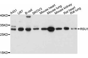 Western blot analysis of extracts of various cell lines, using RSU1 antibody (ABIN4905071) at 1:1000 dilution.
