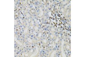 Immunohistochemistry of paraffin-embedded rat kidney using PSMC3 Antibody (ABIN3022704, ABIN3022705, ABIN3022706 and ABIN6219146) at dilution of 1:100 (40x lens).