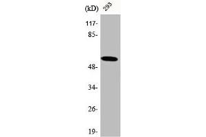 Western Blot analysis of 293 cells using CA IX Polyclonal Antibody