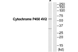 Western blot analysis of extracts from Jurkat cells, using CYP4V2 antibody. (CYP4V2 antibody  (Internal Region))