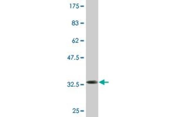 TIMM8A/DDP antibody  (AA 1-72)