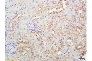 Formalin-fixed and paraffin embedded rat kidney labeled with Rabbit Anti PLEKHM2/SKIP Polyclonal Antibody, Unconjugated (ABIN872446) at 1:200 followed by conjugation to the secondary antibody and DAB staining