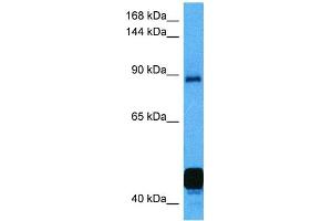 Host:  Mouse  Target Name:  NFATC2  Sample Tissue:  Mouse Kidney  Antibody Dilution:  1ug/ml (NFAT1 antibody  (C-Term))