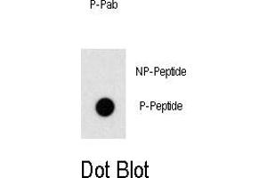 Image no. 1 for anti-Odd-Skipped Related 1 (OSR1) (pThr310) antibody (ABIN358502) (OSR1 antibody  (pThr310))
