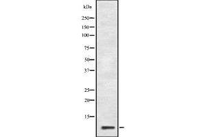 Western blot analysis of GNG10 expression in HepG2 cell lysate,The lane on the left is treated with the antigen-specific peptide. (GNG10 antibody  (Internal Region))