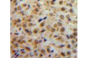 #VALUE! (ESR2 antibody  (AA 149-213))