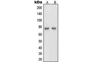 Western blot analysis of Netrin 1 expression in rat brain (A), PC12 (B) whole cell lysates.