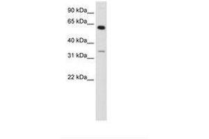 Image no. 1 for anti-Zinc Finger Protein 609 (ZNF609) (AA 71-120) antibody (ABIN202985) (ZNF609 antibody  (AA 71-120))