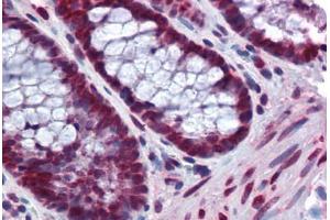 Human Colon: Formalin-Fixed, Paraffin-Embedded (FFPE) (BANF1 antibody  (AA 1-90))
