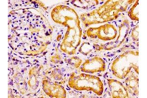 Immunohistochemistry of paraffin-embedded human kidney tissue using ABIN7145946 at dilution of 1:100 (CCRL2 antibody  (AA 1-43))