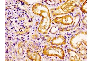 Immunohistochemistry of paraffin-embedded human kidney tissue using ABIN7145946 at dilution of 1:100