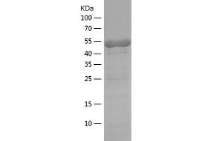 Western Blotting (WB) image for Protein Kinase, AMP-Activated, alpha 1 Catalytic Subunit (PRKAA1) (AA 349-559) protein (His-IF2DI Tag) (ABIN7124656) (PRKAA1 Protein (AA 349-559) (His-IF2DI Tag))