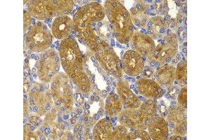 Immunohistochemistry of paraffin-embedded Rat kidney using PRKAB1 Polyclonal Antibody at dilution of 1:100 (40x lens). (PRKAB1 antibody)