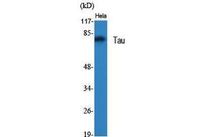 Western Blot (WB) analysis of specific cells using Tau Polyclonal Antibody. (tau antibody  (Ser855))