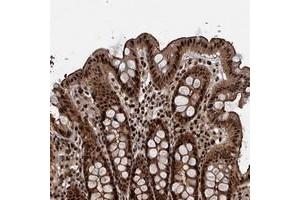 Immunohistochemical staining of human colon with ANKRD49 polyclonal antibody  shows strong nuclear, cytoplasmic and membranous positivity in glandular cells.