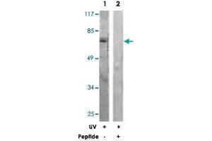 Western blot analysis of extracts from HeLa cells, treated with UV (5 mins), using RAF1 polyclonal antibody .