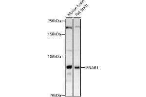 Western blot analysis of extracts of various cell lines, using IFN antibody (ABIN3015552, ABIN3015553, ABIN1680393 and ABIN6218813) at 1:1000 dilution. (IFNAR1 antibody  (AA 28-290))