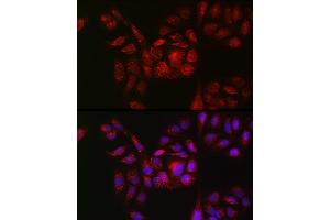 Immunofluorescence analysis of U2OS cells using RB Rabbit pAb (ABIN7269795) at dilution of 1:150 (40x lens). (RAB11B antibody  (AA 130-215))