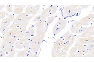 Detection of TNNT2 in Porcine Cardiac Muscle Tissue using Monoclonal Antibody to Troponin T Type 2, Cardiac (TNNT2) (Cardiac Troponin T2 antibody  (AA 1-295))