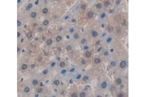 Used in DAB staining on fromalin fixed paraffin- embedded Kidney tissue (KNG1 antibody  (AA 367-430))